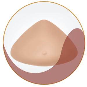 Self-Adhesive Breast Forms